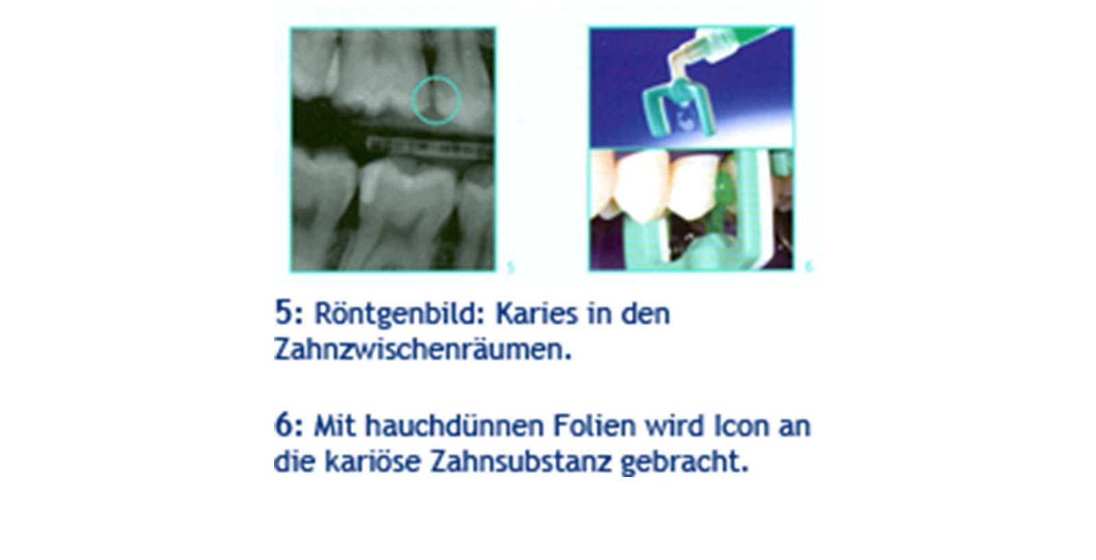 3D Implantatplanung